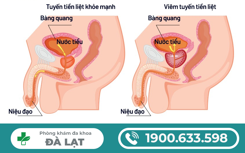 Hình ảnh minh họa